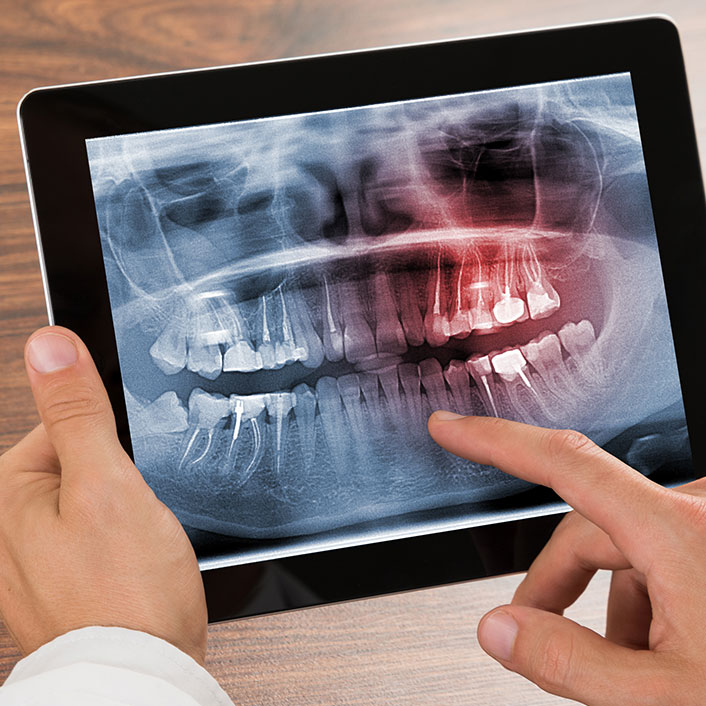 Digital X-rays - Dental Technologies